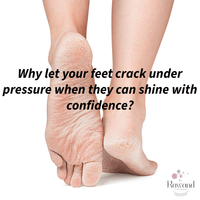Intensive Hyaluronic Acid Cream For Cracked Heels and Dry Feet - Bath & Body Products ByRawand